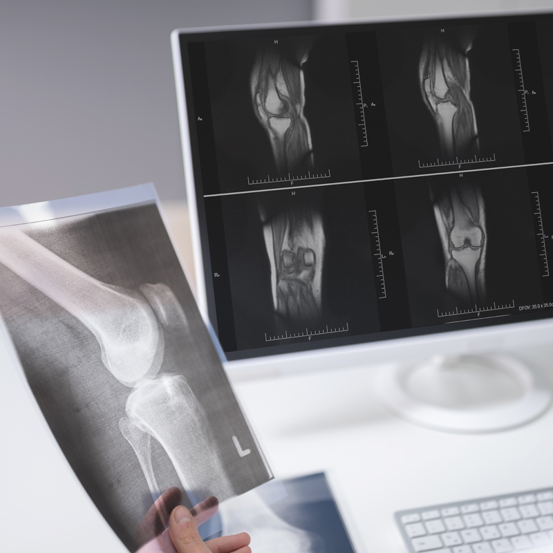 X-ray